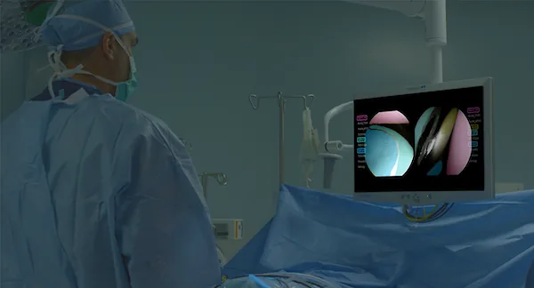 NVIDIA Holoscan (Holoscan)